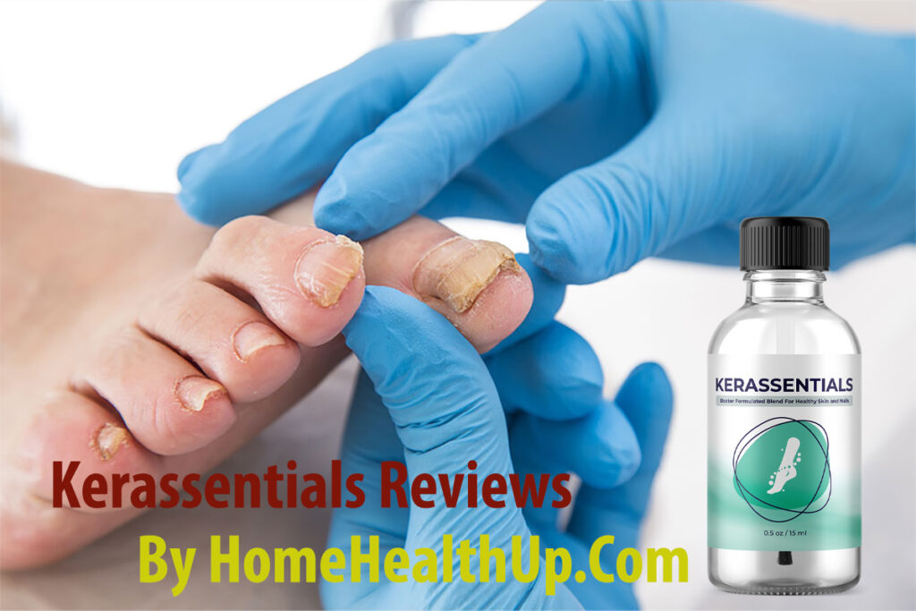 Kerassentials Reviews by HomeHealthUp