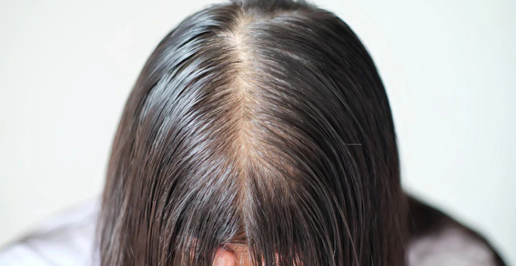 natural-at-home-ways-to-support-hair-growth-and-reduce-thinning